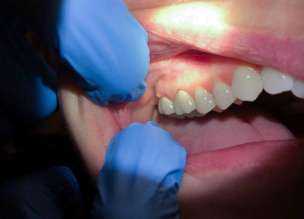 Best Urgent Tooth Repair  in Heppner, OR